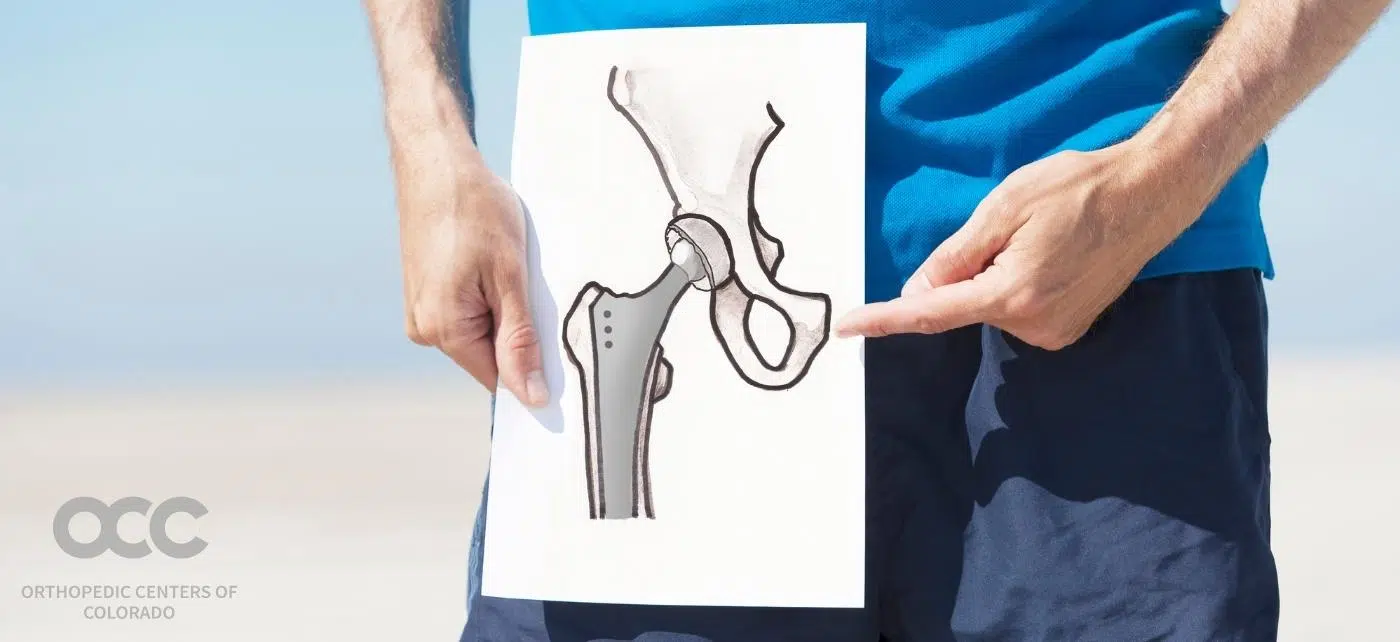 Joint replacement
