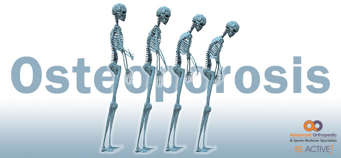 Osteoporosis, Bone Health