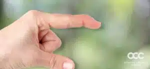 mallet finger